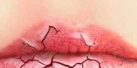 4 съвета как да се справим с напуканите устни