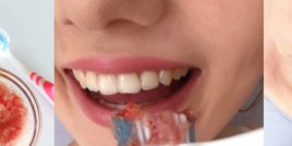 Как да избелим зъбите си натурално?