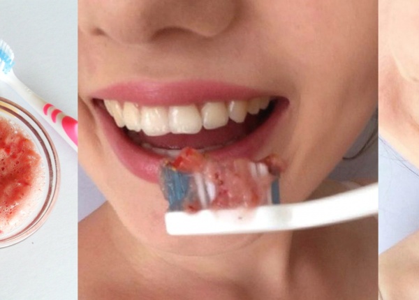 Как да избелим зъбите си натурално?